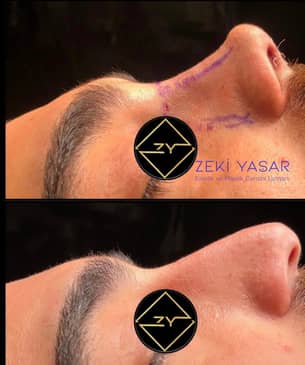 Slider image (7) Dr. Zeki Yasar Clinic